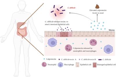 The value of fecal calprotectin in Clostridioides difficile infection: A systematic review